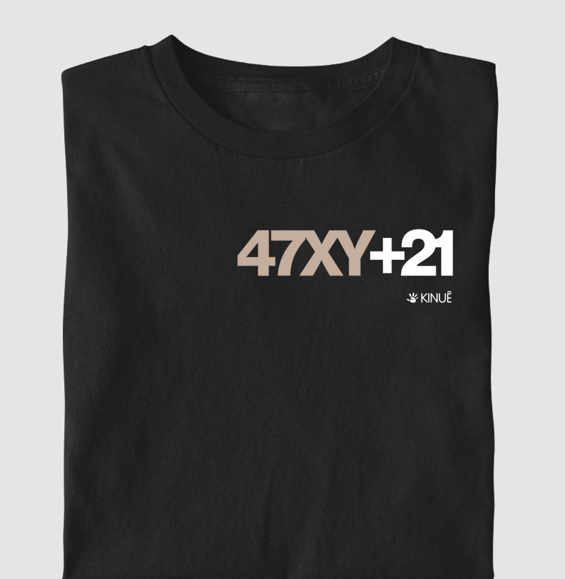 Infantil - 47XY+21 - Representação de exame cariótipo Síndrome de Down