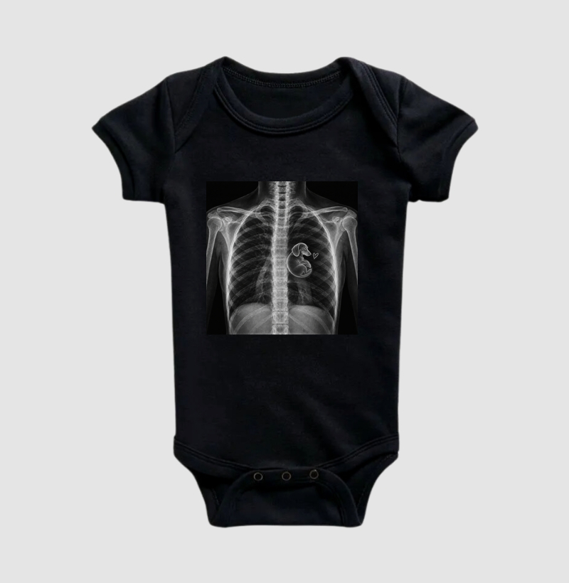 Raio-X Cachorrinho - Body Infantil