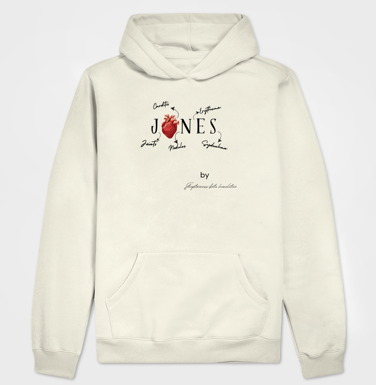 Jones - Febre Reumática